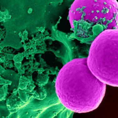 Battling Bacteria - Be Careful How You Clean Your Home
